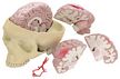 Brain and Partial Skull Model