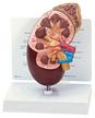 Kidney Model